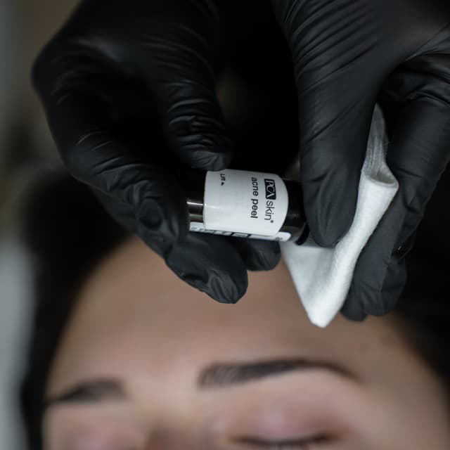 Chemical Peel - 4 Treatments at AP Skin Society in Portsmouth, NH